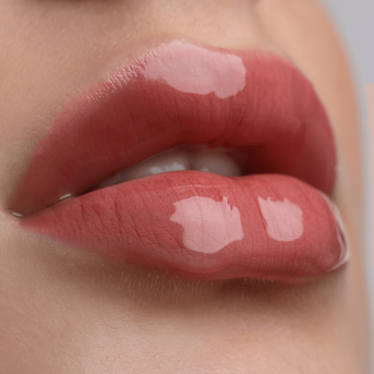 Revolax dermal filler treatment at The Palm Aesthetics Beaconsfield – restore volume and enhance facial contours naturally